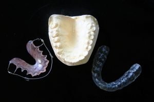 3D打印如何革新医疗领域:4大核心应用与未来趋势